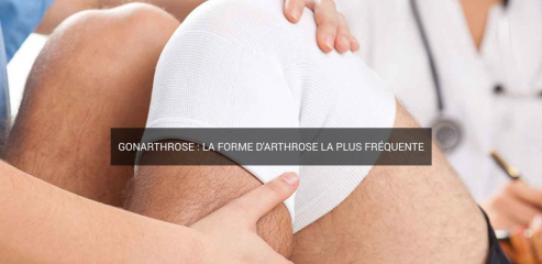 https://www.arthrose-genou.fr